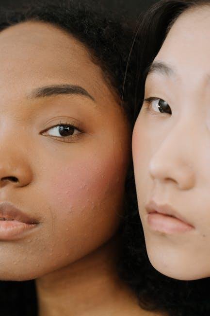 Understanding Acne-Prone⁢ Skin and Its unique Needs